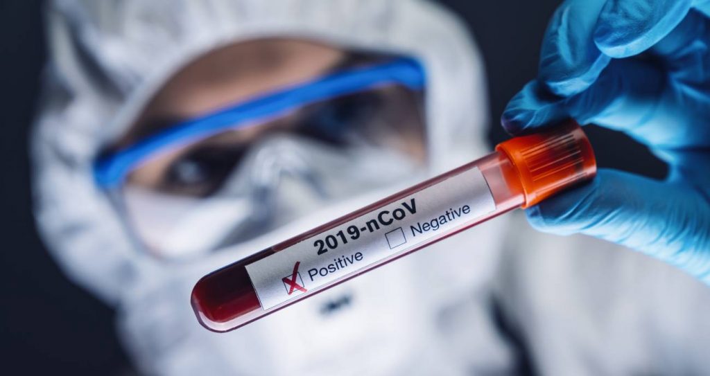 estudio Solidarity sobre tratamientos farmacológicos en pacientes con Covid-19